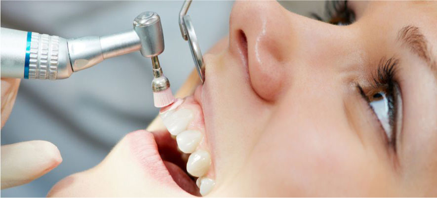 Dental Cleanings