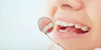 Restoring Missing Teeth