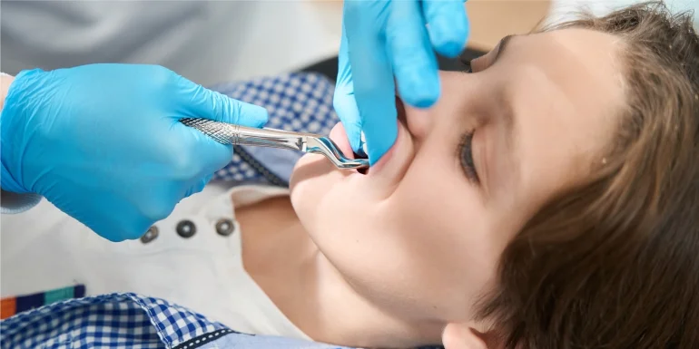 Everything You Need To Know About Dental Bonding
