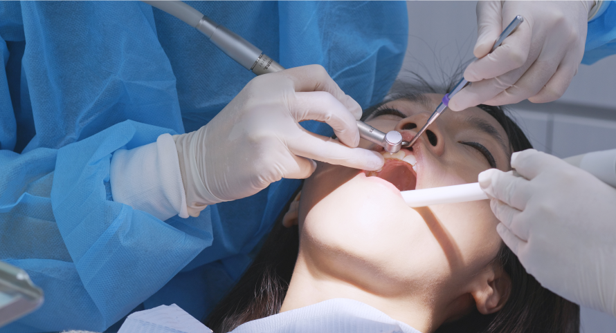 LANAP Laser Gum Surgery